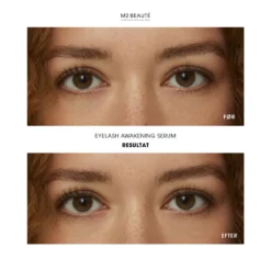 M2 Beauté Eyelash Awakening Serum 4 Ml -Clinique Salgsbutik m2 beaute eyelash awakening serum 4 ml 1681719899