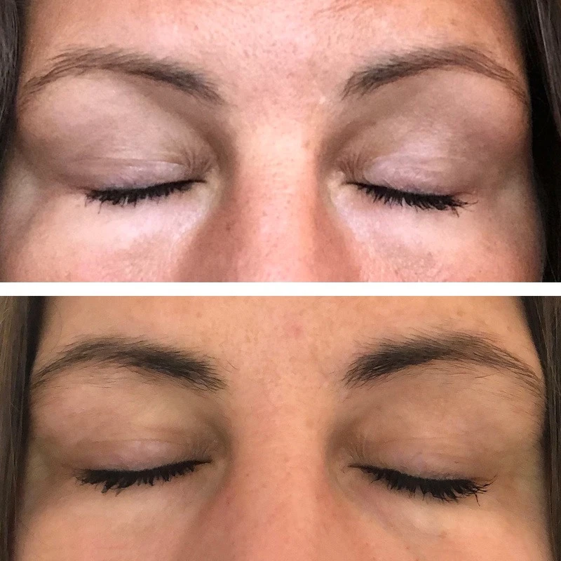 Sanzi Beauty Eyebrow Enhancing Serum 5 Ml 2 Sanzi Beauty Eyebrow Enhancing Serum 5 Ml - Billede 2